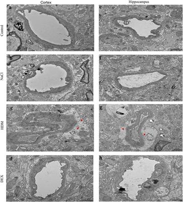 Allergic Asthma-Induced Cognitive Impairment is Alleviated by Dexamethasone